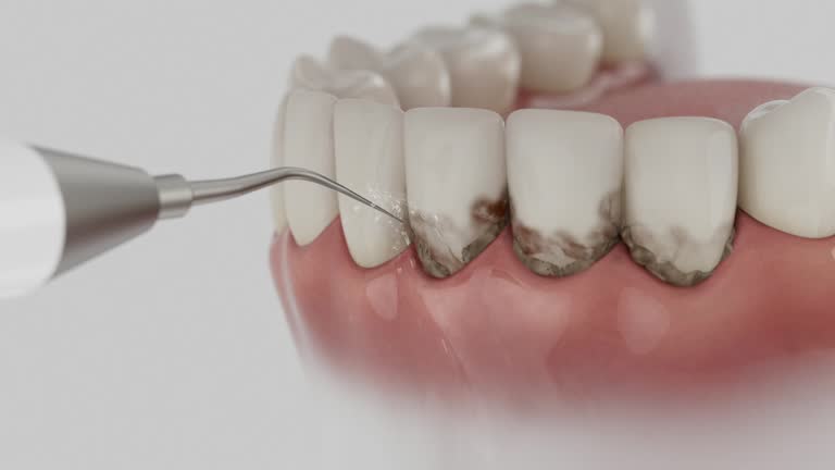 Reliable Dental Implants contractor in Simi Valley, CA by Smile Center Dentistry